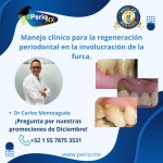 Manejo clínico para la regeneración periodontal en la involucración de la furca.